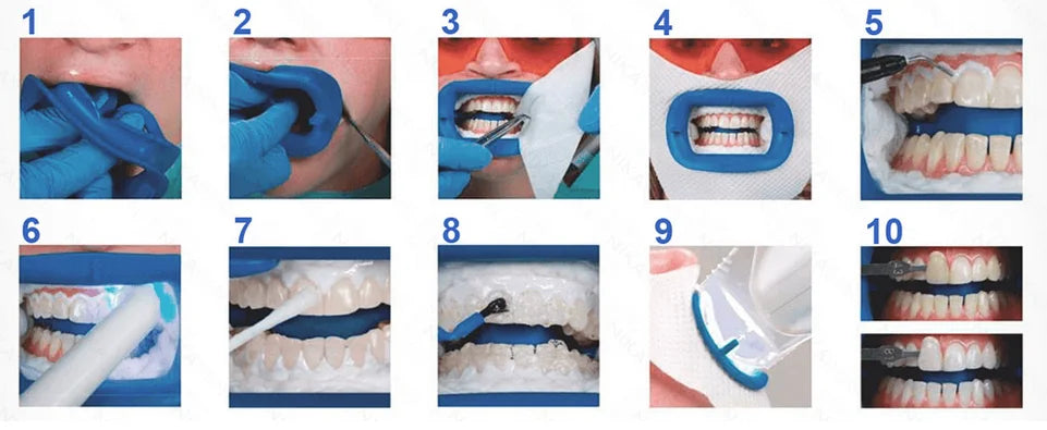 Philips Zoom Whitening Kit Chairside Light-Activated, 2 Person Complete Procedures J3280