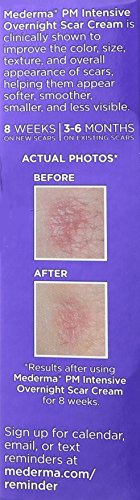 Mederma PM Intensive Overnight Scar Cream 1 Ounce F616311